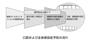 バイオフィルムの病原性と誤嚥性肺炎　