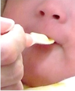 摂食嚥下（せっしょくえんげ）障害をご存知ですか？